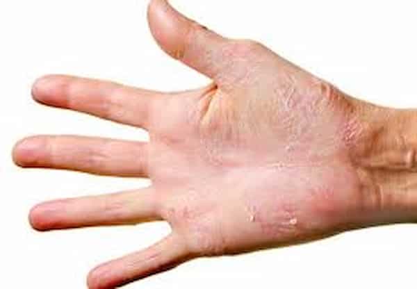 قیمت پماد ترک دست با کیفیت ارزان + خرید عمده